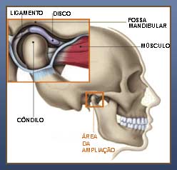 Mandíbula estalando ao abrir e fechar a boca pode ser sinal de disfunção na  ATM (Disfunção Temporomandibular) - Hospital da Face