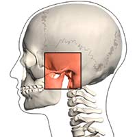 Como Funciona o Tratamento de DTM (disfunção têmporo-mandibular) e